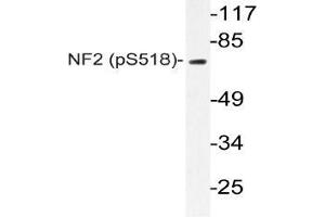 Western blot (WB) analyzes of p-NF2 antibody in extracts from Jurkat IFN cells. (Merlin antibody  (pSer518))