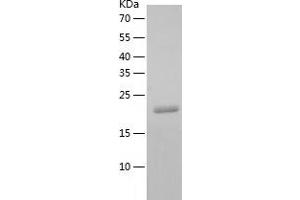 Western Blotting (WB) image for C-Type Lectin Domain Family 4, Member A (CLEC4A) (AA 70-238) protein (His tag) (ABIN7289197) (CLEC4A Protein (AA 70-238) (His tag))