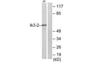 Western blot analysis of extracts from Jurkat cells, using Ik3-2 antibody. (CABLES2 antibody)