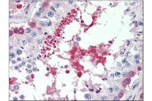 Human Testis (formalin-fixed, paraffin-embedded) stained with SIL1at 5 µg/ml followed by biotinylated anti-goat IgG secondary antibody, alkaline phosphatase-streptavidin and chromogen. (SIL1 antibody  (C-Term))