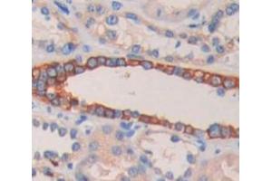 Figure. (RALBP1 antibody  (AA 192-380))
