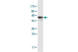 Western Blot detection against Immunogen (59. (AKR1E2 antibody  (AA 1-307))