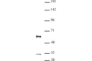 GFI1 antibody (pAb) tested by Western blot. (GFI1 antibody  (N-Term))
