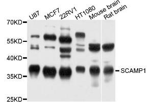 Western blot analysis of extract of various cells, using SCAMP1 antibody.