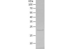 Western Blotting (WB) image for Egf-Like Module Containing, Mucin-Like, Hormone Receptor-Like 1 (EMR1) (AA 376-506) protein (His-IF2DI Tag) (ABIN7282352) (F4/80 Protein (AA 376-506) (His-IF2DI Tag))