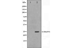 Western blot analysis on RAW264. (SNAP25 antibody  (C-Term))