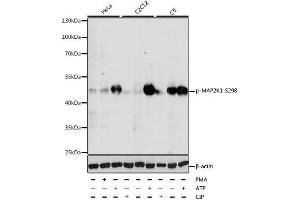 Western blot analysis of extracts of various cell lines, using Phospho-MAP2K1-S298 antibody. (MEK1 antibody  (pSer298))