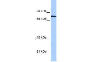 WB Suggested Anti-ZNF45 Antibody Titration:  0. (ZNF45 antibody  (N-Term))