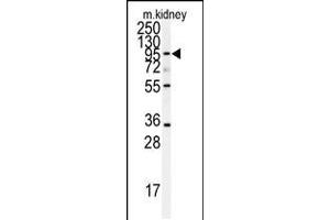 Western blot analysis of anti-ADAM9 Antibody in mouse kidney tissue lysates (35ug/lane) (ADAM9 antibody  (N-Term))