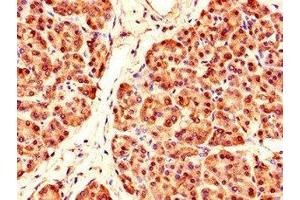 Immunohistochemistry of paraffin-embedded human pancreatic tissue using ABIN7164097 at dilution of 1:100 (PRDM4 antibody  (AA 301-500))