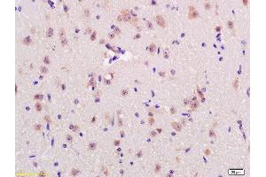 Formalin-fixed and paraffin embedded rat brain labeled with Anti-RNF123 Polyclonal Antibody, Unconjugated  at 1:200 followed by conjugation to the secondary antibody and DAB staining (RNF123 antibody  (AA 2-52))