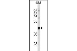 TRUB1 Antibody (Center) (ABIN656716 and ABIN2845945) western blot analysis in uterus tumor cell line lysates (35 μg/lane). (TRUB1 antibody  (AA 152-180))