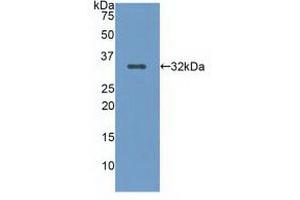 Western blot analysis of recombinant Human LRP5. (LRP5 antibody  (AA 769-1016))