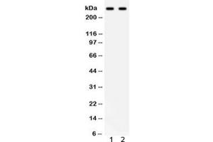 Western blot testing of 1) human HeLa and 2) SW620 lysate with ITPR3 antibody.