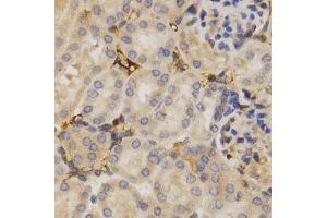 Immunohistochemistry (Paraffin-embedded Sections) (IHC (p)) image for anti-ELAV (Embryonic Lethal, Abnormal Vision, Drosophila)-Like 1 (Hu Antigen R) (ELAVL1) (AA 1-326) antibody (ABIN3022231)