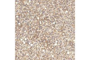 IHC analysis of SGCE using anti-SGCE antibody (ABIN7601544). (SGCE antibody  (AA 38-407))