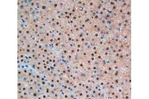 Used in DAB staining on fromalin fixed paraffin- embedded liver tissue (BNP antibody  (AA 27-134))