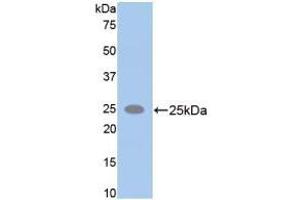Western blot analysis of recombinant Rat SPTAN1. (SPTAN1 antibody  (AA 2071-2269))