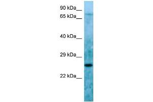 Host: Rabbit Target Name: C11orf48 Sample Type: HepG2 Whole Cell lysates Antibody Dilution: 1. (C11orf48 antibody  (C-Term))