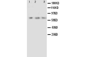 Anti-Angiopoietin 2 antibody, Western blotting Lane 1: Recombinant Human ANG2 Protein 10ng Lane 2: Recombinant Human ANG2 Protein 5ng Lane 3: Recombinant Human ANG2 Protein 2. (Angiopoietin 2 antibody  (C-Term))