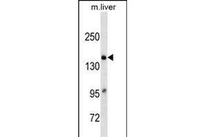 A2M Antibody (C-term)(Ascites) ABIN1539961 western blot analysis in mouse Liver tissue lysates (35 μg/lane). (alpha 2 Macroglobulin antibody  (C-Term))