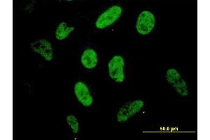 Immunofluorescence of monoclonal antibody to SP1 on HeLa cell. (SP1 antibody  (AA 89-198))