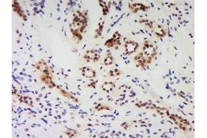 Formalin-fixed and paraffin embedded human kidney labeled with Anti-PNUTS/PPP1R10 Polyclonal Antibody Unconjugated  at 1:200 followed by conjugation to the secondary antibody and DAB staining. (PPP1R10 antibody  (AA 151-250))