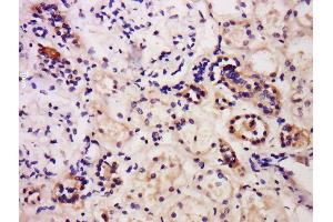 Formalin-fixed and paraffin embedded human kidney labeled with Anti-Caspase-6 Polyclonal Antibody, Unconjugated  at 1:200 followed by conjugation to the secondary antibody and DAB staining. (Caspase 6 antibody  (AA 151-250))