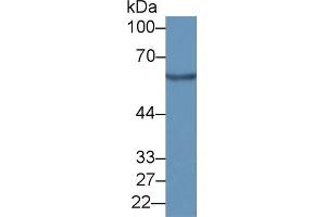 Detection of G6PD in Mouse Testis lysate using Polyclonal Antibody to Glucose-6-phosphate Dehydrogenase (G6PD) (Glucose-6-Phosphate Dehydrogenase antibody  (AA 258-350))