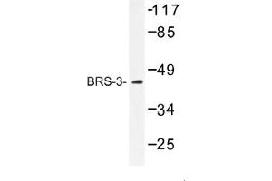Image no. 1 for anti-Bombesin-Like Receptor 3 (BRS3) antibody (ABIN317644) (BRS3 antibody)