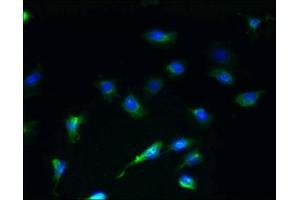 Immunofluorescent analysis of U251 cells using ABIN7168731 at dilution of 1:100 and Alexa Fluor 488-congugated AffiniPure Goat Anti-Rabbit IgG(H+L) (SCAMP4 antibody  (AA 170-228))
