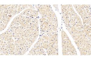 Detection of SOD1 in Bovine Cardiac Muscle Tissue using Monoclonal Antibody to Superoxide Dismutase 1 (SOD1) (SOD1 antibody  (AA 2-152))