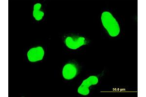 Immunofluorescence of monoclonal antibody to STAT6 on HeLa cell. (STAT6 antibody  (AA 694-801))