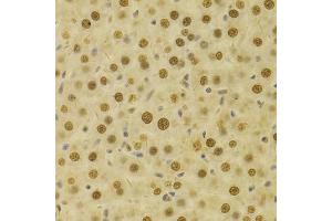 Immunohistochemistry of paraffin-embedded rat liver using HDGF Antibody (ABIN1876535) at dilution of 1:100 (40x lens). (HDGF antibody)