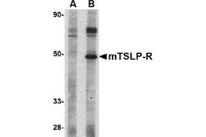 Western blot analysis of TSLP Receptor in mouse heart tissue lysate with this product at 1 μg/ml in (A) the presence and (B) the absence of blocking peptide. (CRLF2 antibody  (Center))