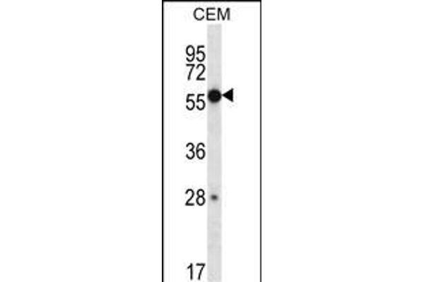 ZNF764 antibody  (AA 84-113)