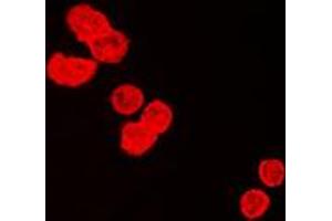Immunofluorescent analysis of BUB3 staining in HeLa cells. (BUB3 antibody  (C-Term))