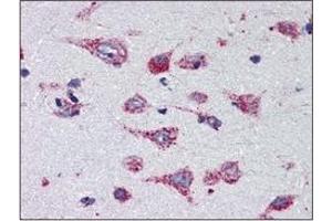 Immunohistochemistry (IHC) image for anti-Cathepsin D (CTSD) (AA 21-412) antibody (ABIN317502) (Cathepsin D antibody  (AA 21-412))