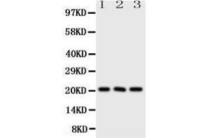 Western Blotting (WB) image for anti-Fibroblast Growth Factor 21 (FGF21) (AA 43-58), (N-Term) antibody (ABIN3044256) (FGF21 antibody  (N-Term))