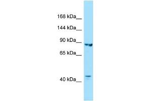 WB Suggested Anti-IPO8 Antibody Titration: 1. (Importin 8 antibody  (C-Term))