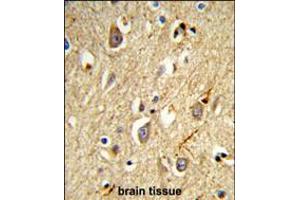 Formalin-fixed and paraffin-embedded human brain tissue reacted with RAB8A Antibody, which was peroxidase-conjugated to the secondary antibody, followed by DAB staining.