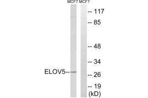 Western blot analysis of extracts from MCF-7 cells, using ELOVL5 antibody. (ELOVL5 antibody)