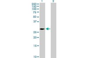 Western Blot analysis of PRKAB2 expression in transfected 293T cell line by PRKAB2 MaxPab polyclonal antibody. (PRKAB2 antibody  (AA 1-272))