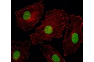 Fluorescent image of HUVEC cells stained with ISL2 antibody. (ISL2 antibody  (AA 1-30))