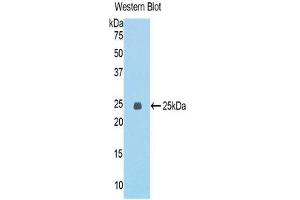 ECT2 antibody  (AA 453-647)