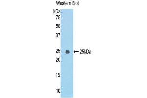 Western Blotting (WB) image for anti-Epithelial Cell Transforming Sequence 2 Oncogene (ECT2) (AA 453-647) antibody (ABIN1858683)