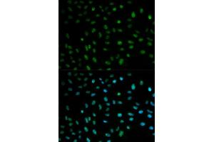 Immunofluorescence analysis of MCF7 cell using ELAVL1 antibody. (ELAVL1 antibody  (AA 1-326))