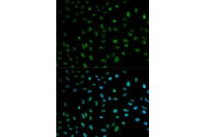 Immunofluorescence analysis of MCF7 cell using ELAVL1 antibody. (ELAVL1 antibody  (AA 1-326))
