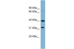 WB Suggested Anti-C9orf4 Antibody Titration:  0. (Ferric-Chelate Reductase 1 Like (FRRS1L) (Middle Region) antibody)