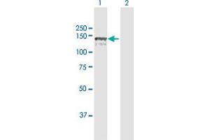 Western Blot analysis of CC2D1A expression in transfected 293T cell line by CC2D1A MaxPab polyclonal antibody. (CC2D1A antibody  (AA 1-951))